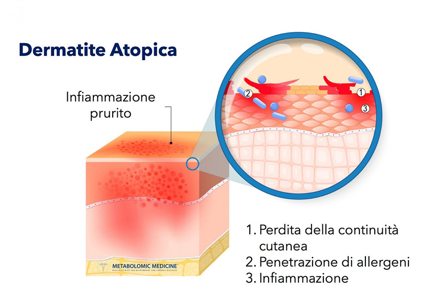 La Cura Della Dermatite Atopica Nei Bambini E Adulti Nutratopic Isdin Farmacia Pelizzo